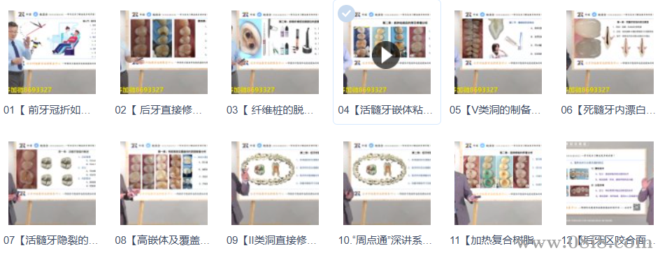 周锐“周点通”深讲系列课程18节（修牙补牙教程）